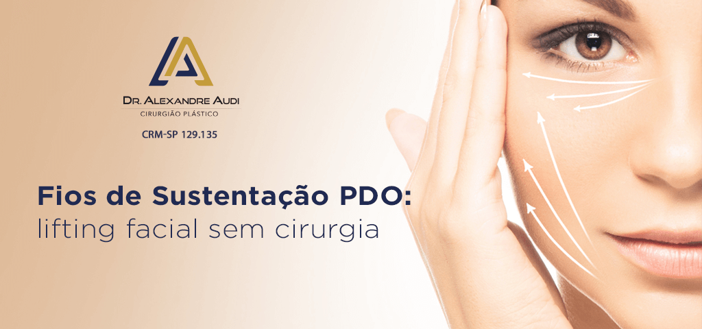 Fios de Sustentação (PDO) o Lifting NÃO cirurgico - saiba TUDO sobre!