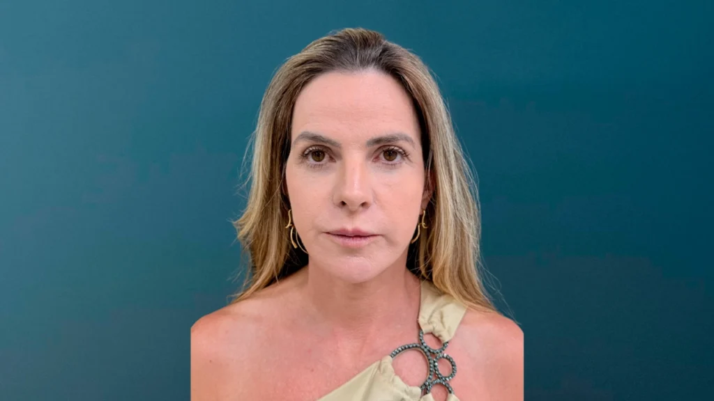 Depois